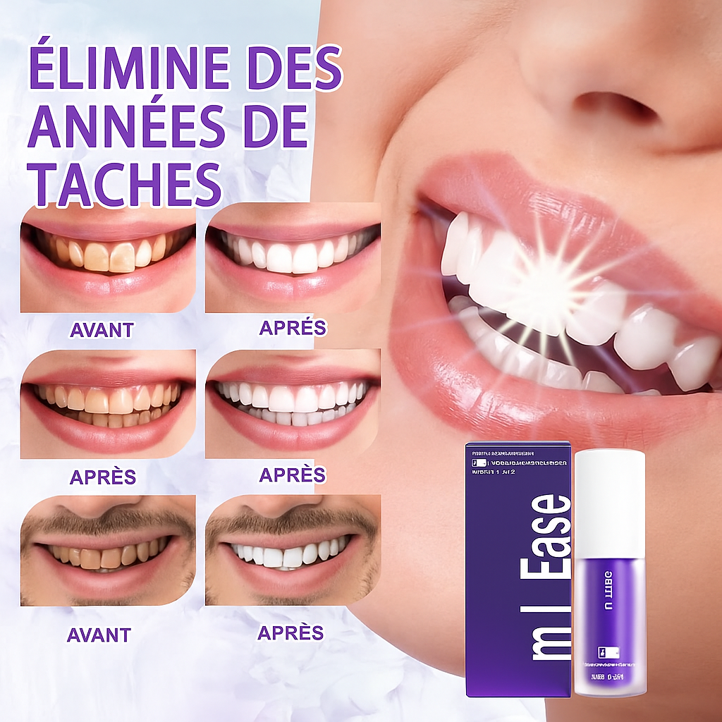 هاي سمايل مصحح اللون، تبييض الأسنان الأرجوان،